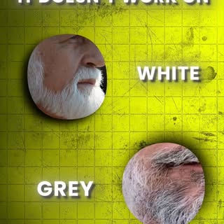Dreaming of a fuller beard?

Discover the power of a beard transplant to achieve the look you've alw