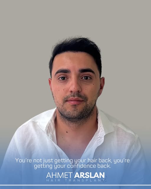 You’re not just getting your hair back, you’re getting your confidence back.

All surgical and inter