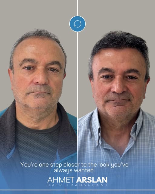 İşte o çok beklenen danışanımızın son hali!

All surgical and interventional procedures may have res