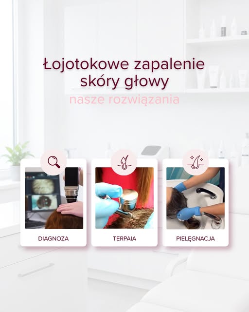 Łojotokowe zapalenie skóry głowy wymaga kompleksowego podejścia 💜

W gabinecie stawiamy na diagnost