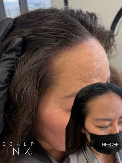 Small details. A fuller-looking hairline. ✨

Women’s scalp micropigmentation in Las Vegas at Scalp I