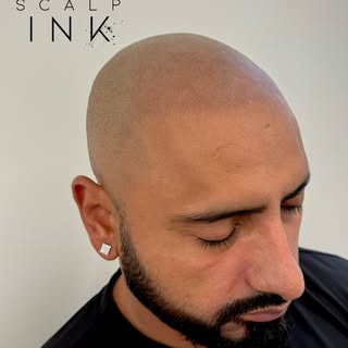 What if your hairline could look like it never left? 👀

This is the power of a well-executed scalp 