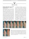 Rapid skin repigmentation on oral ruxolitinib in a patient with coexistent vitiligo and alopecia areata (AA)