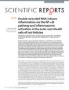 Double-stranded RNA induces inflammation via the NF-κB pathway and inflammasome activation in the outer root sheath cells of hair follicles