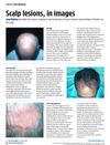 Scalp lesions, in images