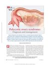 Polycystic Ovary Syndrome: Overview and Management