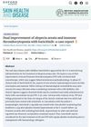 Dual Improvement of Alopecia Areata and Immune Thrombocytopenia With Baricitinib: A Case Report