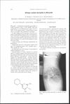 Allergic contact dermatitis to Minoxidil