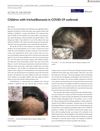 Children with Trichotillomania During the COVID-19 Outbreak