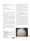 Frontal fibrosing alopecia: follow-up of a brazilian group