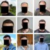 One and half year after the hair transplant