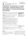 Cytokeratin 15 expression in central, centrifugal, cicatricial alopecia: new observations in normal and diseased hair follicles