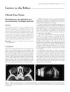 Clinical Case Notes. Intraorbital ophthalmic artery aneurysms