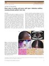 Rare case of Leydig cell tumor with type I diabetes mellitus causing female pattern hair loss