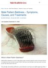 Male Pattern Baldness: Symptoms, Causes, and Treatments