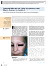 Segmental Vitiligo and Hair Curling After Interferon α and Ribavirin Treatment for Hepatitis C