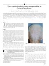 Tinea capitis in adult women masquerading as bacterial pyoderma
