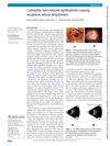 Caterpillar Hair-Induced Ophthalmitis Causing Exudative Retinal Detachment