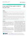 A case report of tinea capitis in infant in first year of life