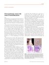 Clinicopathologic study of 90 cases of trichofolliculoma