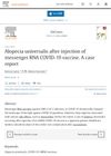 Alopecia Universalis After Injection of Messenger RNA COVID-19 Vaccine: A Case Report