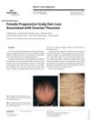 Female Progressive Scalp Hair Loss Associated with Ovarian Thecoma