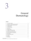 General Dermatology: Comprehensive Overview of Dermatological Conditions