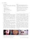 Nasal sporotrichosis in children