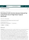 Secondary Cutis Verticis Gyrata Induced by Long-Term Use of High-Dose Topical Minoxidil