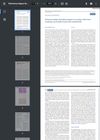 Refractory/Relapse Thrombocytopenia in a Patient With Evans' Syndrome Successfully Treated With Zanubrutinib