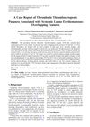 A Case Report of Thrombotic Thrombocytopenic Purpura Associated with Systemic Lupus Erythematosus: Overlapping Features