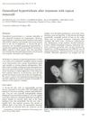 Generalized hypertrichosis after treatment with topical minoxidil
