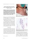 Salivary Gland Choristoma (Heterotopic Salivary Gland Tissue) on the Anterior Chest Wall of a Newborn
