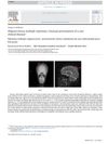 Oligosecretory multiple myeloma: Unusual presentation of a rare clinical disease
