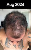 Shedding or receding even more?