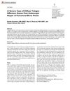 A Severe Case of Diffuse Telogen Effluvium Status Post Endoscopic Repair of Functional Brow Ptosis