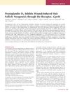 Prostaglandin D2 Inhibits Wound-Induced Hair Follicle Neogenesis through the Receptor, Gpr44