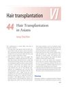 Hair Transplantation in Asians