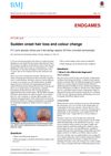 Sudden onset hair loss and colour change