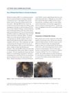 Use of Platelet-Rich Plasma in Cicatricial Alopecia