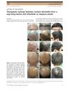Therapeutic Synergy Between Contact Dermatitis from a Wig-Fixing Device and Tofacitinib on Alopecia Areata