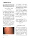 CUTANEOUS MASTOCYTOSIS IN CHILDREN: AN INDIAN EXPERIENCE
