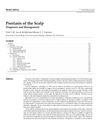 Psoriasis of the Scalp