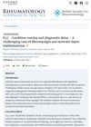 P47 Condition Overlay And Diagnostic Delay – A Challenging Case Of Fibromyalgia And Systemic Lupus Erythematosus