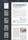 Novel Mutations of the ABCA12, KRT1 and ST14 Genes in Three Unrelated Newborns Showing Congenital Ichthyosis