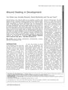 Wound Healing in Development: Mechanisms and Regulation
