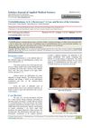 Trichofolliculoma: Is It A Recurrence? A Case and Review of the Literature