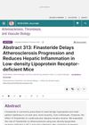 Finasteride Delays Atherosclerosis Progression and Reduces Hepatic Inflammation in Low-Density Lipoprotein Receptor-Deficient Mice