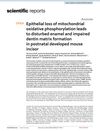 Epithelial loss of mitochondrial oxidative phosphorylation leads to disturbed enamel and impaired dentin matrix formation in postnatal developed mouse incisor