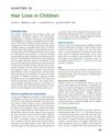 Hair Loss in Children: A Detailed Overview of Pediatric Alopecia